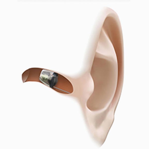 custom fitted hearing aids